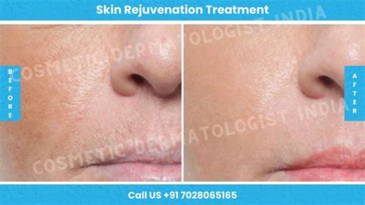 A Journey Of Skin Rejuvenation