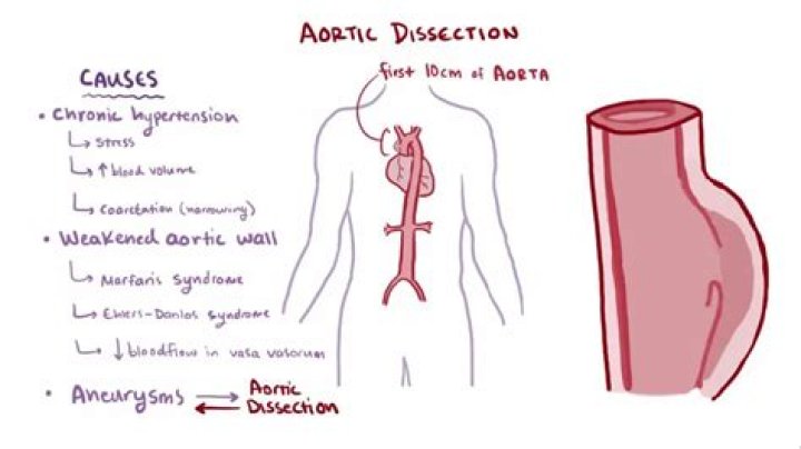 An In-Depth Dissection Of Chris