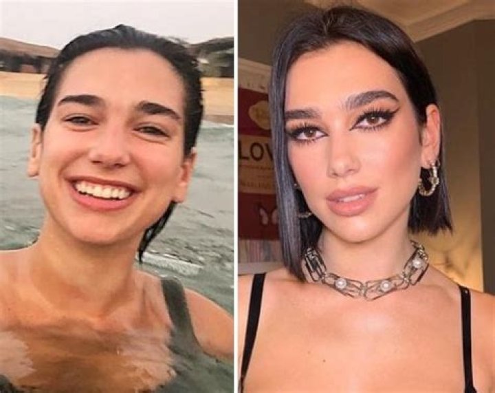 Dua Lipa Nose Job Did She Underwent Surgery? Before And After