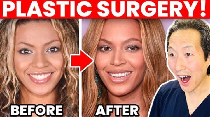 Has Beyonc Ever Had Plastic Surgery?