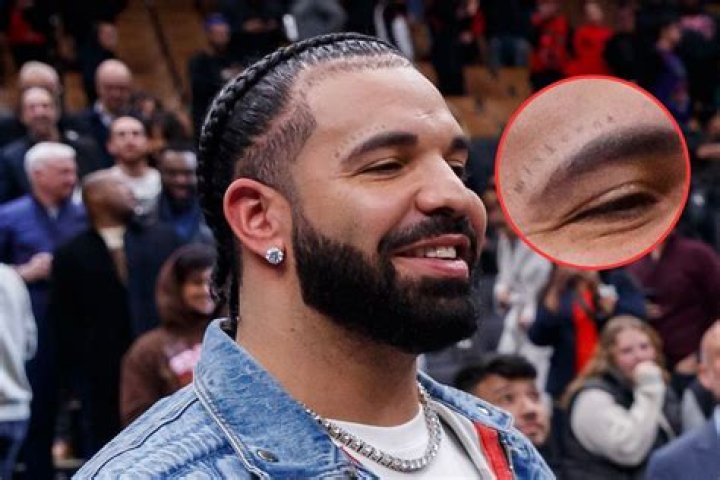 Unveiling The Hidden Meaning: Drake's Face Tattoo Decoded!