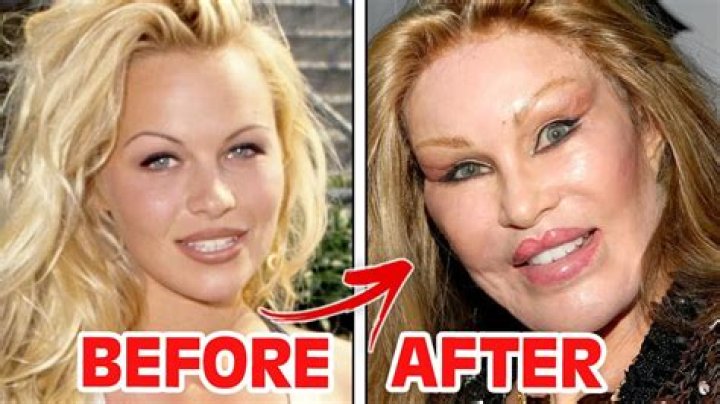 Unveiling The Secrets Of Plastic Surgery: Before And After SB19
